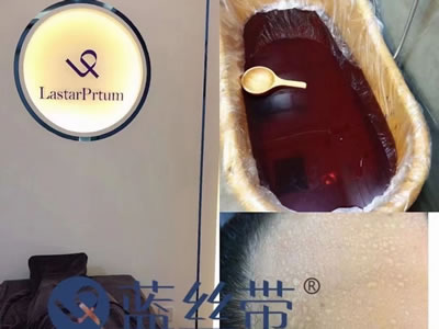 藍絲帶產(chǎn)后恢復中心環(huán)境圖