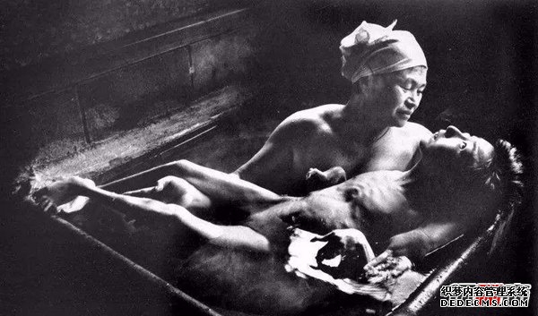 日本水俁病事件,環(huán)境污染導致人們染上“怪病”