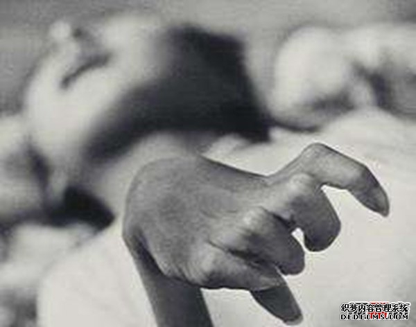 日本水俁病事件,環(huán)境污染導致人們染上“怪病”